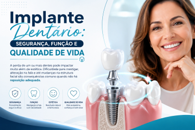 Implante Dent&aacute;rio: Seguran&ccedil;a, Fun&ccedil;&atilde;o e Qualidade de Vida